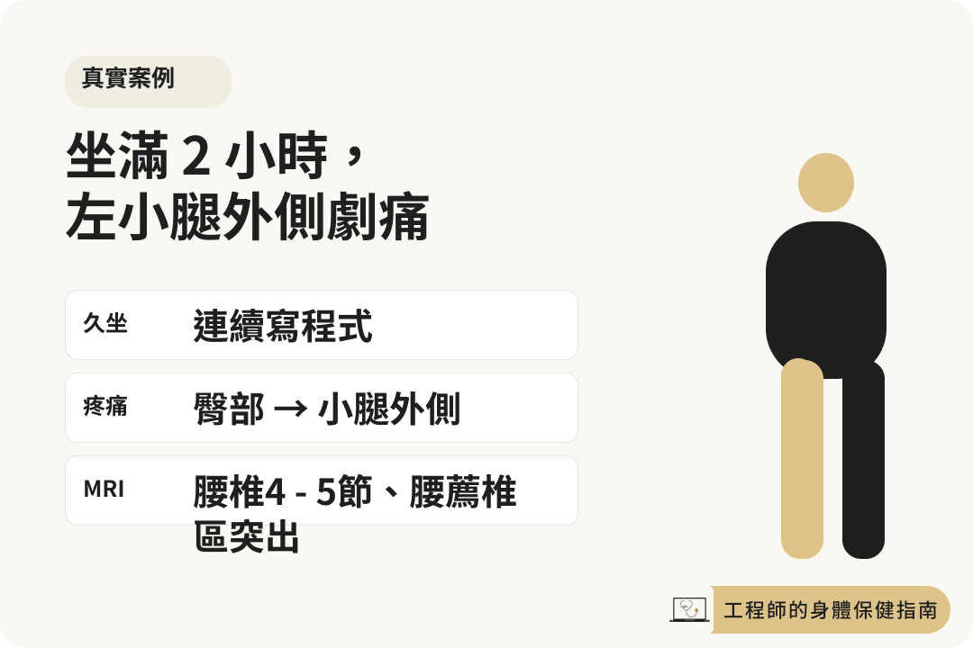 久坐兩小時後左小腿外側痛的案例
